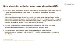 Brain stimulation methods – vagus nerve stimulation (VNS)
